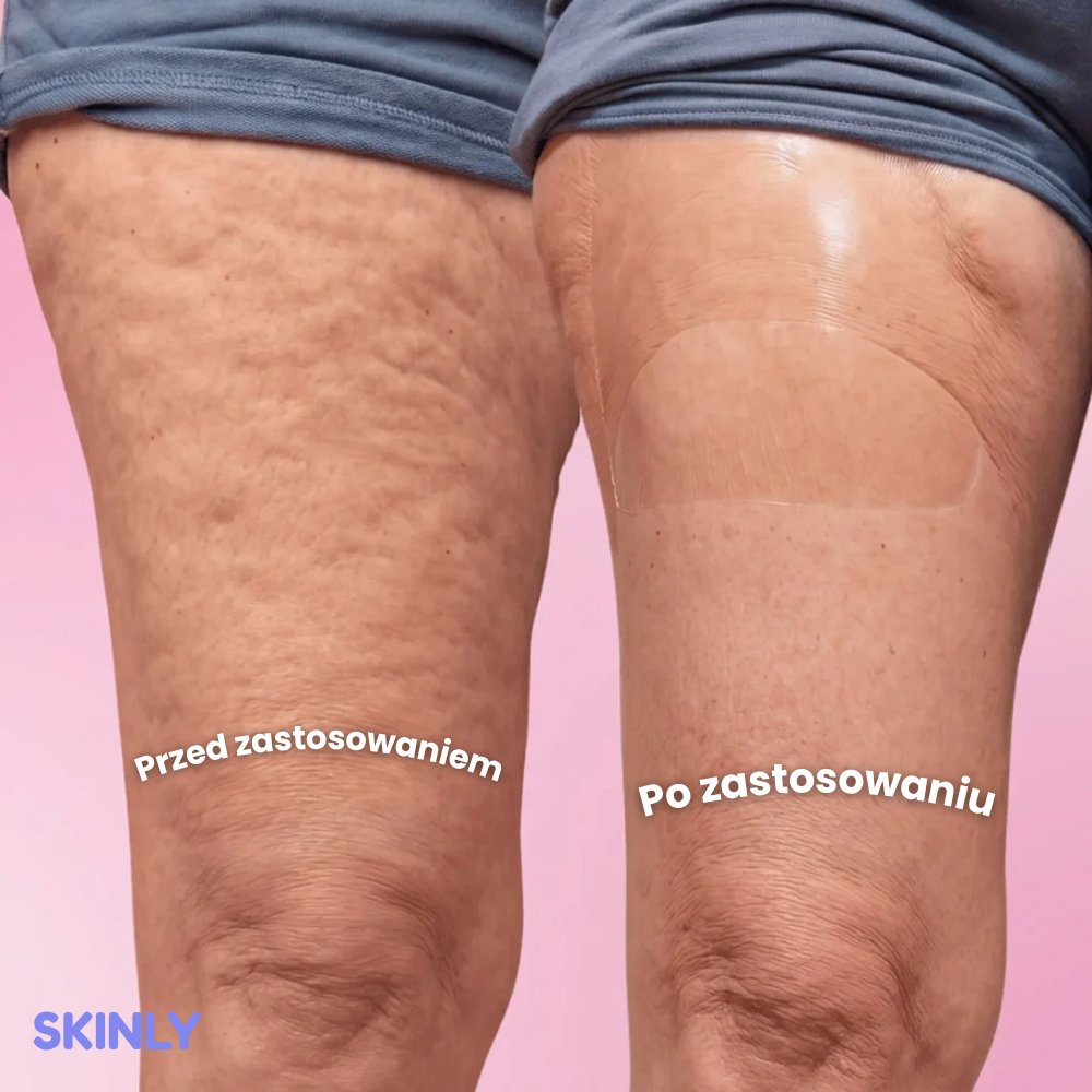 Skinly™ Taśma Liftingująca