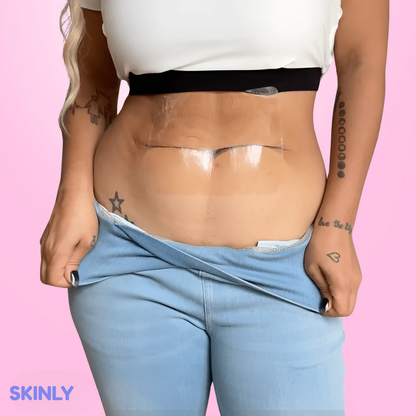Skinly™ Taśma Liftingująca